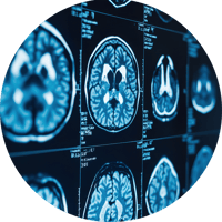 medical imaging